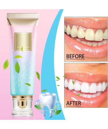 Niacinamide Whitening Toothpaste with Niacinamide 100 g Niacinamide Whitening Toothpaste Teeth Whitening Toothpaste Stain Removal and Whitening - Buy Online on GoSupps.com