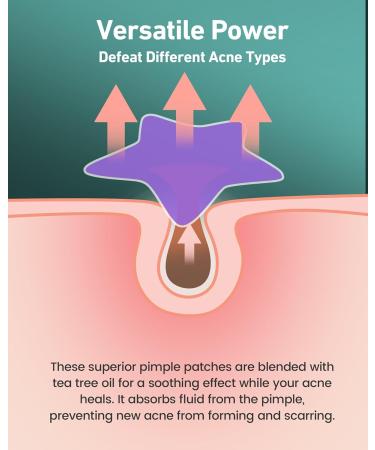 112 Dots Star Acne Patches | Cute Hydrocolloid Pimple Patches for Face - Turquoise Blue Pink & Purple Healing Stickers - Buy Online on GoSupps.com