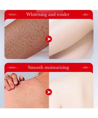 Body Gla-ze Strawberry Shortcake Body Gla-ze Body Butter Strawberry Body Butter for Women Brightening Body Lotion Firming Body Cream Body Lotion for Dry Skin Moisturizing Skincare Body Butter Cream - Buy Online on GoSupps.com