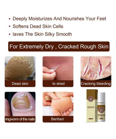 2pc Athlete's Foot & Peeling Spray Set - 60ml | Foot Odor Eliminator for Men & Women - Buy Online on GoSupps.com