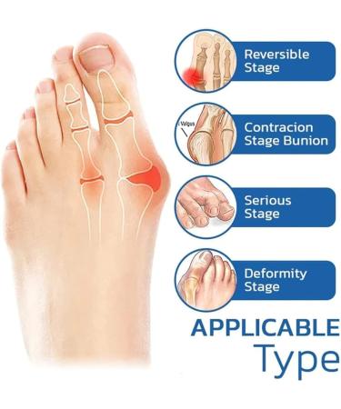 Folenzu Bunion Relief Socks - 5pcs Set for Orthoes & Projoint Antibunions - Grey Compression Toe Socks - Buy Online on GoSupps.com