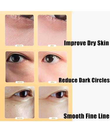 Rose Moisturize Eye Cream Eye Cream Anti Aging Eye Cream for Dark Circles And Puffy Eyes Dark Circles Under Eye Treatment Women Under Eye Cream Anti-Aging Moisturizing for Fine Lines Lightweight - Buy Online on GoSupps.com
