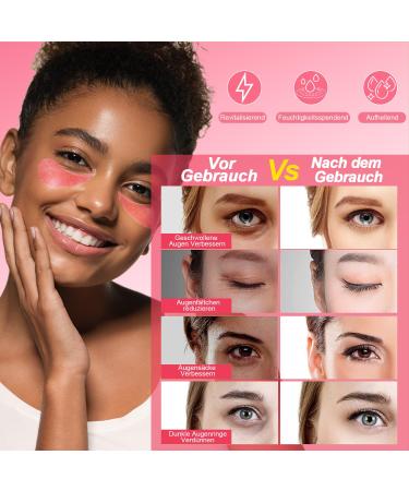 60 Rose Eye Pads - Dark Circle Puffiness & Wrinkle Treatment - Soothing Eye Masks for Instant Refresh - Buy Online on GoSupps.com
