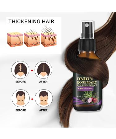 Organic Hair Growth Spray with Onion Oil, Rosemary & Black Seed - Control Hair Loss and Promote Healthy Hair Growth - Buy Online on GoSupps.com