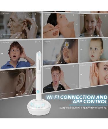 Wireless Earwax Otoscope with Charging Station and 14 Cleaning Tools | 3M High-definition Camera | 3-level LEDs | for iOS & Android - Buy Online on GoSupps.com