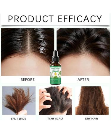 Hair Regrowth Oil - Follicle Stimulator 60 Milliliters Anti-Hair Loss Treatment | For Travel Daily Care After-Cut Shampoo Hair Preparation - Buy Online on GoSupps.com