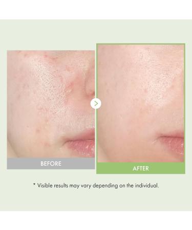 Nourish & Soothe Duo: TOSOWOONG Real Relief Noni Ampoule & Exosome Cica Face Cream for Hydration and Skin Repair - Buy Online on GoSupps.com