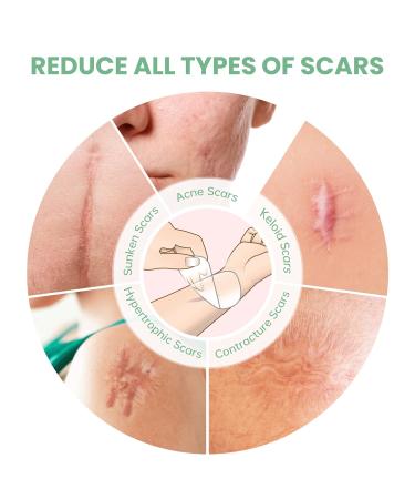 Mebak C-Section Silicone Scar Sheets - Medical Grade Reusable Treatment Patches for Keloid Surgical Scars Removal - Transparent, 8 Inches Long - Buy Online on GoSupps.com