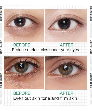 Bamboo Charcoal Collagen Eye Patches for Dark Circle - Wrinkle Patches - Moisturizing Eye Masks - Eye Bags Remover - Fading Fine Lines and Firming Skin - Buy Online on GoSupps.com