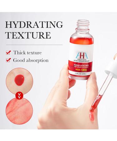 Friut Acid Face Serum for Acne Mark Salicylic Acid Anti Wrinkle Serum Fade Ance Mark & Shrink Pore Face Serum Hyaluronic Acid Acne Repair Serum for Sensitive Skin Smoothing Hyaluronic Serum-30ml - Buy Online on GoSupps.com