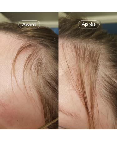 OMUM - Mon Coup de Pousse Hair Growth & Strengthening Supplement - 60 Capsules 1 Month - Nettle Arugula Bamboo Biotin Zinc - Natural Made in France Vegan Breastfeeding Compatible - Buy Online on GoSupps.com