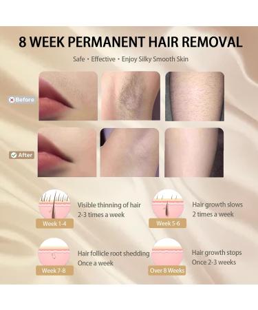IPL Laser Hair Removal Device for Women Men Whole Body Use - White - Buy Online on GoSupps.com