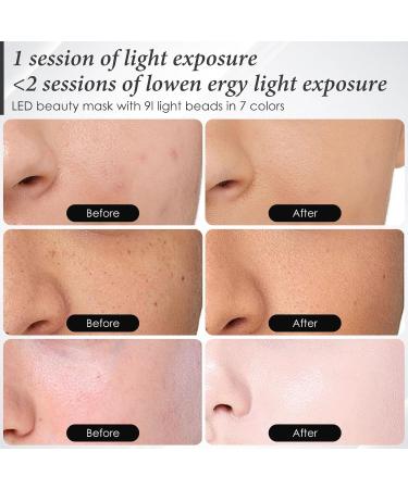 7-in-1 LED Facial Skin Care Mask | Red Light Therapy for Home Use | Black G1 - Illuminate Your Skin - Buy Online on GoSupps.com