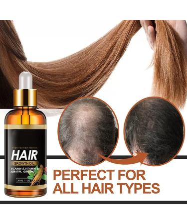 30ml Ginger Hair Growth Serum Hair Growth Treatment Oil for Men Women Anti Hair Loss Thinning Promote Hair Regrowth - Buy Online on GoSupps.com