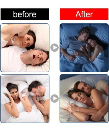 Kopana Mouth Tape - 60 Counts for Better Sleep | Sleep Tape for Improved Breathing during Sleep - Buy Online on GoSupps.com