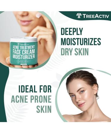 TreeActiv Acne Treatment Face Cream with Salicylic Acid & Tea Tree Oil - 90 Day Supply - Buy Online on GoSupps.com