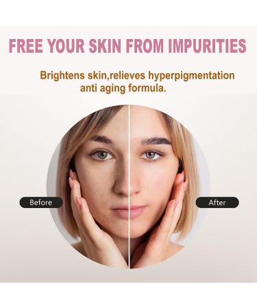 Bright Skin Cosmetics Refresh and Revitalize Cucumber Eye Cream - 2 oz Dark Circles Treatment Unisex Eye Moisturizer for Dry Skin - Buy Online on GoSupps.com