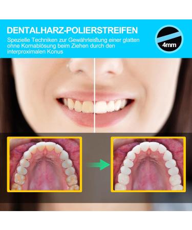 Buy Aisely Tooth Sandpaper - 2 Dental Polishing Strips 4mm Wide 6m Roll - Interdental Grinding Tools for Polishing Teeth - Blue - Buy Online on GoSupps.com
