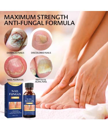 Extra Strength Toe Nail Fungus Treatment - Effective Nail Repair Solution for Healthy Nails - Buy Online on GoSupps.com