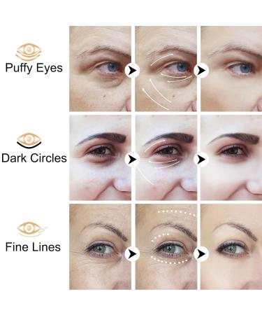 Caffeine Eye Stick - Reduce Puffiness & Dark Circles Hyaluronic Acid & Vitamin C for Under Eye Treatment | Wrinkles Fine Lines Bags & Crow's Feet Solution - Buy Online on GoSupps.com