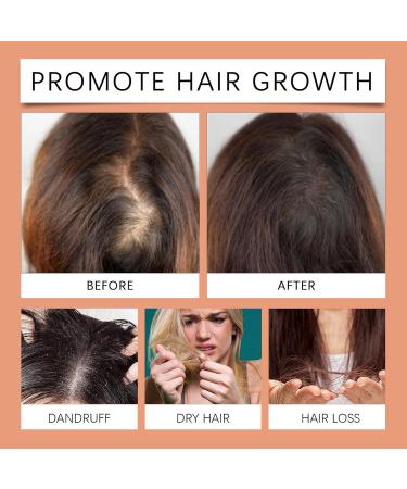 Pumpkin Oil Hair Growth Oil Scalp Care Liquid Drops Promotes Thickness and Nourishment Portable Convenient Packaging 30ml for Damaged Hair Travel and Home Use - Buy Online on GoSupps.com