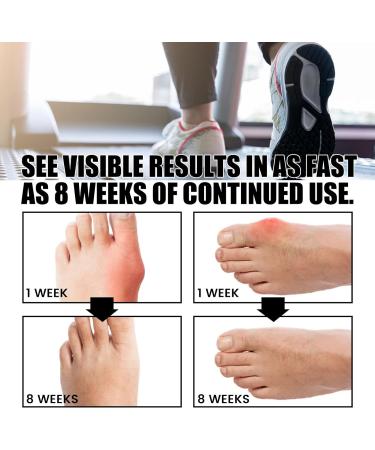 Projoint Anti Bunion Health Socks for Women and Men - Bunion Corrector with Strongjoints Relief and Orthopedic Compression - Buy Online on GoSupps.com