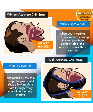 Acusnore MAX Action Anti Snoring Chin Strap - Adjustable Comfortable Universal Snore Stopper - Buy Online on GoSupps.com