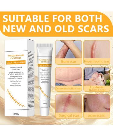 OIXYAZ 1 Piece Scar Cream Gel for Scars Repairing Cream Improve Skin Appearance Daily Use Reduce Skin Imperfections - Buy Online on GoSupps.com