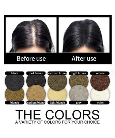 100% Natural Cotton Scatter Hair Powder for Immediate Hair Coverage - Bulk Hair Compression for Men & Women (25g White) - Shop Internationally! - Buy Online on GoSupps.com