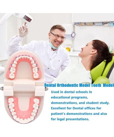 Dytah Orthodontic Demonstration Model - Teeth Study Model with Metal Arch Wire & Brackets for Effective Teaching - Buy Online on GoSupps.com