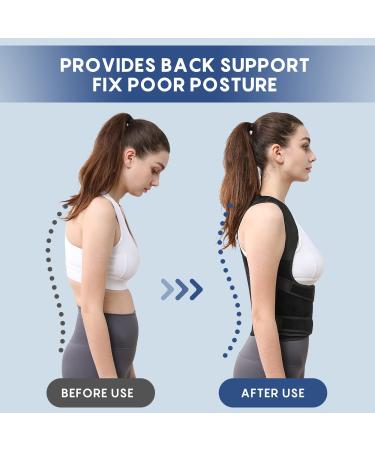 Suptrust Posture Corrector for Women and Men - Back Support Belt, Upper Back Brace, Scoliosis and Hunchback Corrector (Medium Size) - Buy Online on GoSupps.com