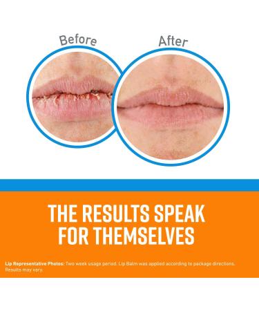 O'Keeffe's Cooling Relief Lip Repair Balm for Dry, Cracked Lips - 0.35 oz Tube - Buy Online on GoSupps.com