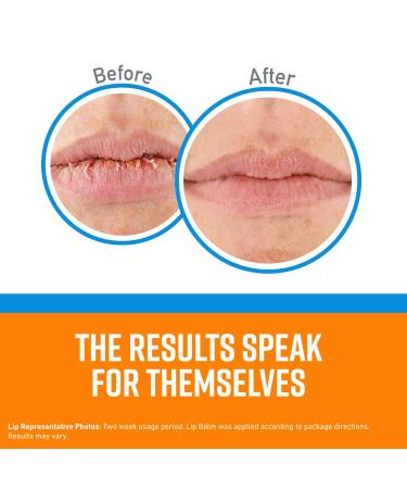 O'Keeffe's Cooling Relief Lip Repair Lip Balm - Pack of 4 - Buy Online on GoSupps.com