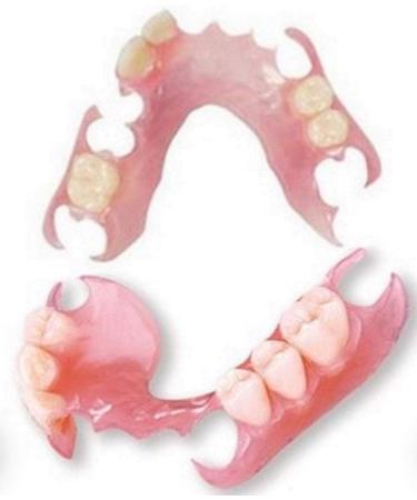 Affordable Flexible Valplast Customized Partial Denture (Pink, Valplast) Pink Valplast