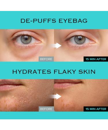 mimmua! Brightening & Dark Spot Care Bundle | Ice Sorbet Toner Pads + Dark Spot Ampoule + NIACINDY Radiance Capsule Cream | Depuffing Skin Prep, Hyperpigmentation Treatment & Radiance Moisturizer Set - Buy Online on GoSupps.com