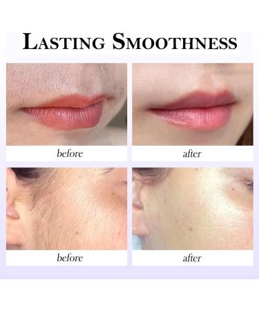  blmcoos Medicpure Facial Hair Removal with Soothing Serum Depilatory Cream for Sensitive Skin Upper Lip and Chin Hair Removal for Women Gentle Face and Body Hair Removal Cream Painless Effective (3) - Buy Online on GoSupps.com