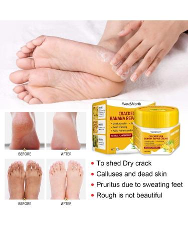 Foot Repair Cream for Dry Cracked Feet | Callus Remover for Men & Women | Ultimate Foot Care Solution - Unit Size A - Buy Online on GoSupps.com