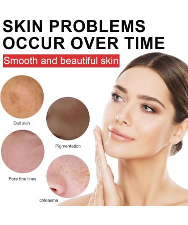  Wootapson Dark Spot Corrector Cream Skin Brightening Lotion Firming Moisturizing Cream hydrates effectively reduces skin imperfections and brightens the complexion Suitable for all - Buy Online on GoSupps.com