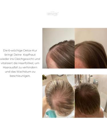 Balance Hairgrowth Activator - Hair growth activator - Buy Online on GoSupps.com