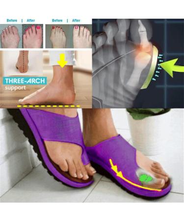 FFMA Women's Big Toe Correction Sandal - Orthopedic Bunion Corrector with Arch Support and Toe Straightening - Yellow, Size 11 - Buy Online on GoSupps.com