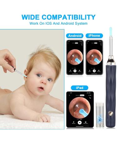 1080p WiFi Ear Wax Removal Otoscope - Waterproof Endoscope with LED Light for iPhone iPad & Android - Buy Online on GoSupps.com