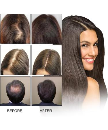 Ginger Hair Growth Mist Hair Growth Serum Herbal Mist for Hair Regrowth Natural Nourishing Scalp Mist for Hair Loss - Buy Online on GoSupps.com