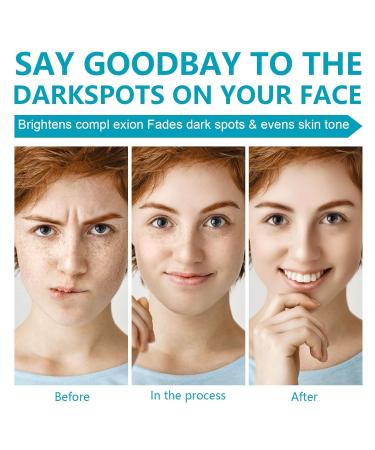 Dark Spot Remover Cream for Face & Body | Blemish Corrector for Age Spots Melasma Freckles & Sun Spots - Effective Dark Spot Treatment for Men & Women - Buy Online on GoSupps.com