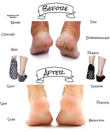 Moisturizing Gel Socks for Repairing Dry Feet - Infused with Essential Oils and Vitamins - Black and Gray - Buy Online on GoSupps.com