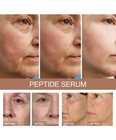 Vitamin C Vitamin E Facial Serum Anti Aging Facial Super Vit C Serum for Dark Spots Skin Care 30ML (2pc) - Buy Online on GoSupps.com