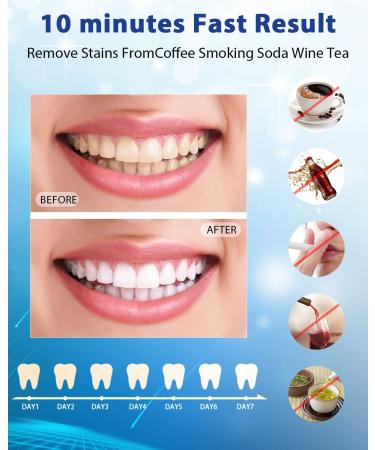 AZ Smile Teeth Whitening Gel Refill - 6 No-Sensitive Syringes, Peroxide-Free Whitener for Fast 10-Minute Results with LED Light - Buy Online on GoSupps.com