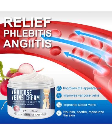 Varicose Veins Cream - Natural Treatment for Legs, Improve Blood Circulation, Strengthen Capillaries & Relieve Tired Legs - Buy Online on GoSupps.com