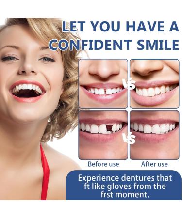 VRYNDH Cosmetic dental facets 2 pairs teeth whitening temporary dental prosthesis safe and comfortable instant smile with heatadhesive beads for temporary repair of dental problems - Buy Online on GoSupps.com