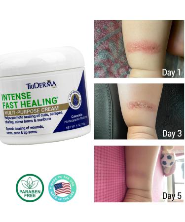 TriDerma Intense Fast Healing Cream - Quick Relief for Rashes Cuts & Scrapes | Value Pack of 2 x 4 oz Jars - International Shipping Available - Buy Online on GoSupps.com