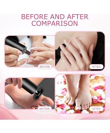 Ranrose Multifunction Electric Callus Remover - 2 in 1 Rechargeable Foot File with Nail Drill Bit & 6 Speeds | Professional Pedicure Tool for Smooth Feet - Black - Buy Online on GoSupps.com